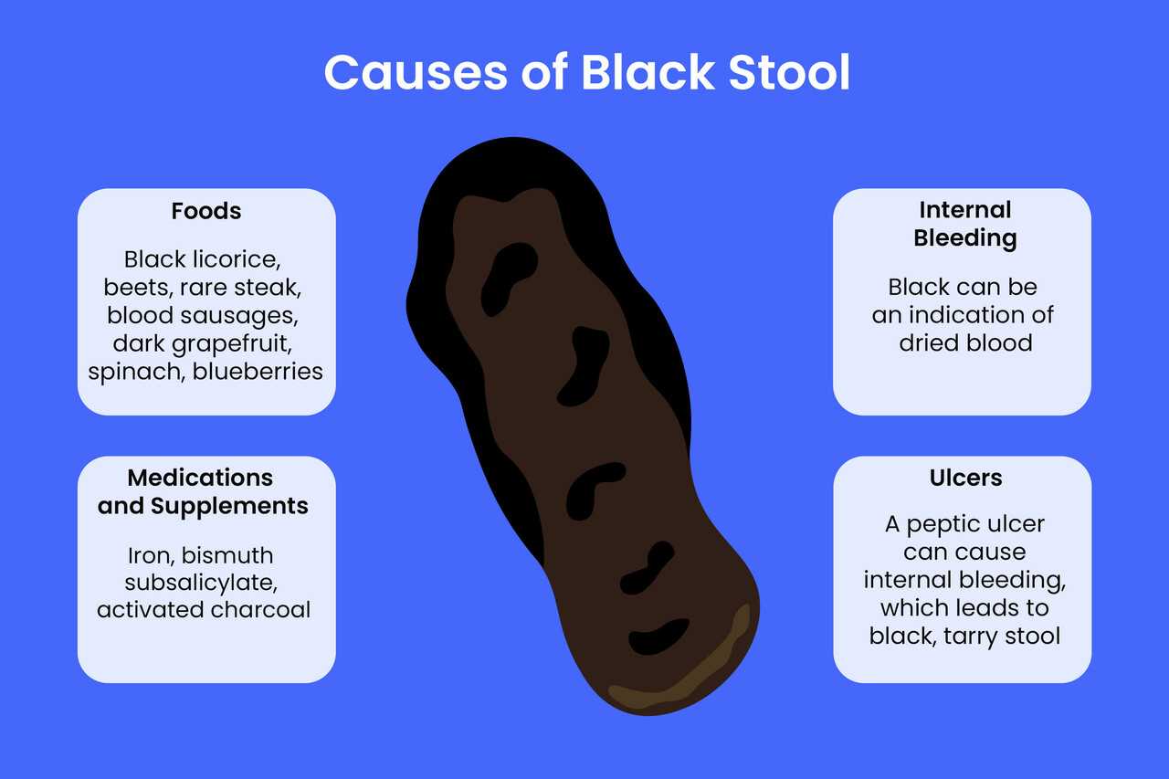 The Role of Diet in Stool Color Changes